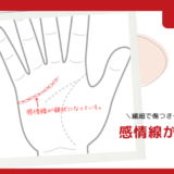 感情線が鎖状｜繊細で傷つきやすい人