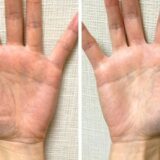 LINEコールde鑑定｜変形マスカケ＋離れ型のAさん